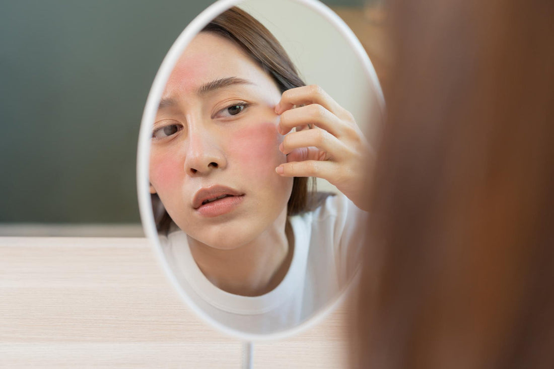 A woman looking in an oval mirror at severe facial redness, seeking the best cream for eczema itching relief.