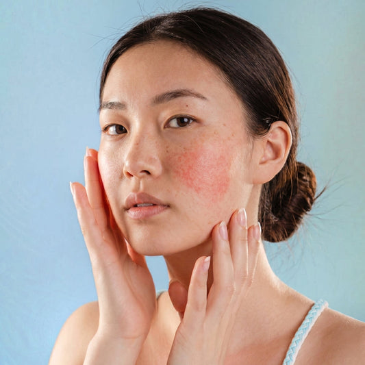 Sensitive, Irritation-Prone or Troubled Skin: Which One Do You Have? (2026)